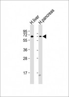 GCKR Antibody - All lanes: Anti-GCKR Antibody (N-Term) at 1:2000 dilution. Lane 1: human liver lysates. Lane 2: human pancreas lysates Lysates/proteins at 20 ug per lane. Secondary Goat Anti-Rabbit IgG, (H+L), Peroxidase conjugated at 1:10000 dilution. Predicted band size: 69 kDa. Blocking/Dilution buffer: 5% NFDM/TBST.