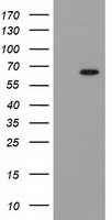 GCKR Antibody - HEK293T cells were transfected with the pCMV6-ENTRY control. (Left lane) or pCMV6-ENTRY GCKR. (Right lane) cDNA for 48 hrs and lysed