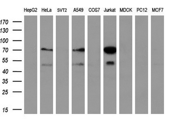 GCKR Antibody - Western blot analysis of extracts. (35ug) from 9 different cell lines by using anti-GCKR monoclonal antibody. (HepG2: human; HeLa: human; SVT2: mouse; A549: human; COS7: monkey; Jurkat: human; MDCK: canine;rat; MCF7: human). (1:200)