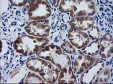 GCKR Antibody - Immunohistochemical staining of paraffin-embedded Human Kidney tissue within the normal limits using anti-GCKR mouse monoclonal antibody. (Heat-induced epitope retrieval by 10mM citric buffer, pH6.0, 100C for 10min,