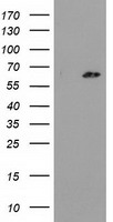 GCKR Antibody - HEK293T cells were transfected with the pCMV6-ENTRY control (Left lane) or pCMV6-ENTRY GCKR (Right lane) cDNA for 48 hrs and lysed. Equivalent amounts of cell lysates (5 ug per lane) were separated by SDS-PAGE and immunoblotted with anti-GCKR.