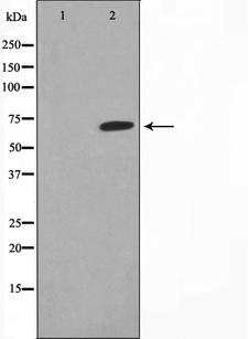GCKR Antibody - Western blot analysis on mouse heart cell lysates using HeLa antibody. The lane on the left is treated with the antigen-specific peptide.
