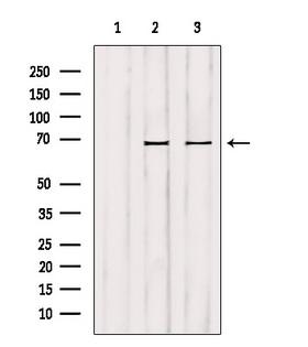 GCKR Antibody - Western blot analysis of extracts of various samples using GCKR antibody. Lane 1: mouse lung treated with blocking peptide. Lane 2: mouse lung; Lane 3: HuvEc;