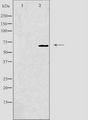 GCKR Antibody - Western blot analysis of extracts of mouse heart cells using Glucokinase Regulator antibody. The lane on the left is treated with the antigen-specific peptide.