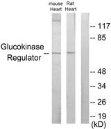 GCKR Antibody - Western blot analysis of extracts from mouse heart cells and rat heart cells, using Glucokinase Regulator antibody.