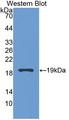 GCL / Grancalcin Antibody - Western blot of GCL / Grancalcin antibody.