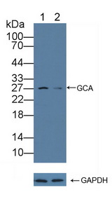 GCL / Grancalcin Antibody - Knockout Varification: Lane 1: Wild-type HL60 cell lysate; Lane 2: GCA knockout HL60 cell lysate; Predicted MW: 24kd Observed MW: 27kd Primary Ab: 1µg/ml Rabbit Anti-Human GCA Antibody Second Ab: 0.2µg/mL HRP-Linked Caprine Anti-Rabbit IgG Polyclonal Antibody