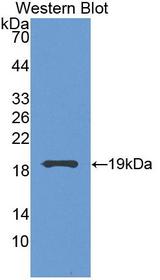 GCL / Grancalcin Antibody - Western blot of GCL / Grancalcin antibody.