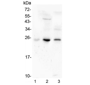 GCL / Grancalcin Antibody - Western blot testing of human 1) placenta, 2) HL-60 and 3) Caco-2 lysate with Grancalcin antibody at 0.5ug/ml. Predicted molecular weight ~24 kDa.