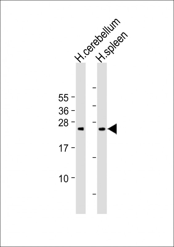 GCL / Grancalcin Antibody - All lanes: Anti-GCA Antibody (N-Term) at 1:2000 dilution Lane 1: Human cerebellum lysate Lane 2: Human spleen lysate Lysates/proteins at 20 µg per lane. Secondary Goat Anti-Rabbit IgG, (H+L), Peroxidase conjugated at 1/10000 dilution. Predicted band size: 24 kDa Blocking/Dilution buffer: 5% NFDM/TBST.
