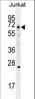 GCLC Antibody - GCLC Antibody western blot of Jurkat cell line lysates (35 ug/lane). The GCLC antibody detected the GCLC protein (arrow).