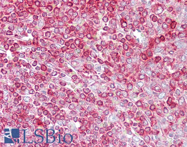 GCLC Antibody - Anti-GCLC antibody IHC of human spleen. Immunohistochemistry of formalin-fixed, paraffin-embedded tissue after heat-induced antigen retrieval. Antibody concentration 5 ug/ml.  This image was taken for the unconjugated form of this product. Other forms have not been tested.