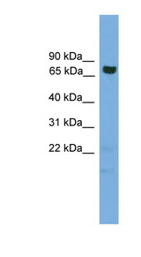 GCLC Antibody - GCLC antibody Western blot of Placenta lysate. This image was taken for the unconjugated form of this product. Other forms have not been tested.
