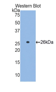 GCLC Antibody - Western blot of recombinant GCLC.  This image was taken for the unconjugated form of this product. Other forms have not been tested.