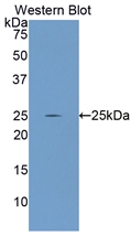GCLC Antibody - Western Blot; Sample: Recombinant protein.