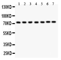 GCLC Antibody - GCLC antibody Western blot. All lanes: Anti GCLC at 0.5 ug/ml. Lane 1: Rat Brain Tissue Lysate at 50 ug. Lane 2: Rat Cardiac Muscle Tissue Lysate at 50 ug. Lane 3: HELA Cell Lysate at 40 ug. Lane 4: PC-12 Whole Cell Lysate at 40 ug. Lane 5: NRK Whole Cell Lysate at 40 ug. Lane 6: HEPA Whole Cell Lysate at 40 ug. Lane 7: A549 Whole Cell Lysate at 40 ug. Predicted band size: 72 kD. Observed band size: 72 kD.