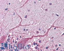 GCLC Antibody - Anti-GCLC antibody IHC of human brain-cerebellum. Immunohistochemistry of formalin-fixed, paraffin-embedded tissue after heat-induced antigen retrieval. Antibody concentration 5 ug/ml.  This image was taken for the unconjugated form of this product. Other forms have not been tested.