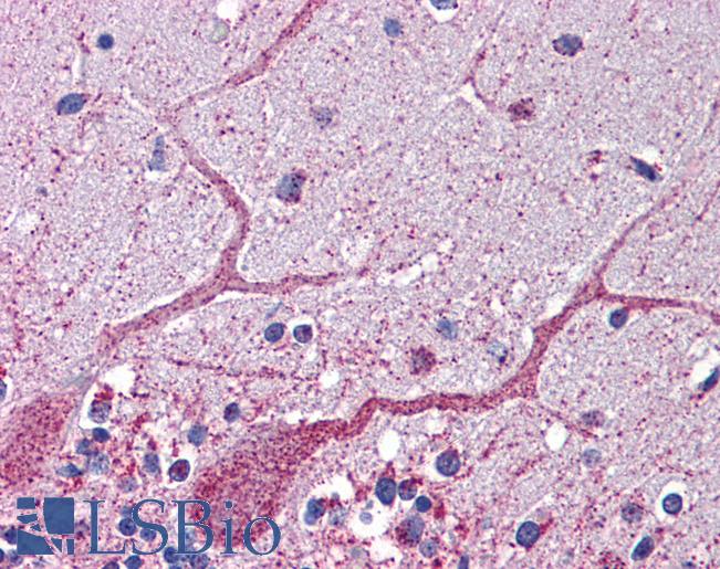 GCLC Antibody - Anti-GCLC antibody IHC of human brain-cerebellum. Immunohistochemistry of formalin-fixed, paraffin-embedded tissue after heat-induced antigen retrieval. Antibody concentration 5 ug/ml.  This image was taken for the unconjugated form of this product. Other forms have not been tested.