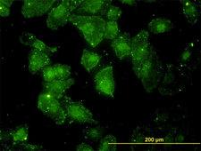 GCLC Antibody - Immunofluorescence of monoclonal antibody to GCLC on HeLa cell. [antibody concentration 10 ug/ml]