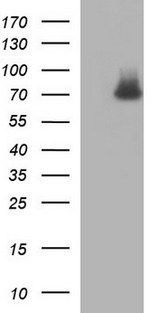 GCLC Antibody - HEK293T cells were transfected with the pCMV6-ENTRY control (Left lane) or pCMV6-ENTRY GCLC (Right lane) cDNA for 48 hrs and lysed. Equivalent amounts of cell lysates (5 ug per lane) were separated by SDS-PAGE and immunoblotted with anti-GCLC.