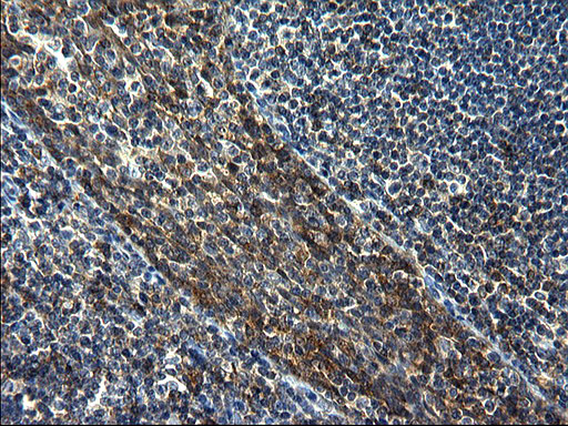 GCLC Antibody - IHC of paraffin-embedded Human lymph node tissue using anti-GCLC mouse monoclonal antibody. (Heat-induced epitope retrieval by 1 mM EDTA in 10mM Tris, pH8.5, 120°C for 3min).