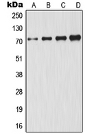 GCLC Antibody - Western blot analysis of GCLC expression in HeLa (A); A431 (B); Jurkat (C); HepG2 (D) whole cell lysates.