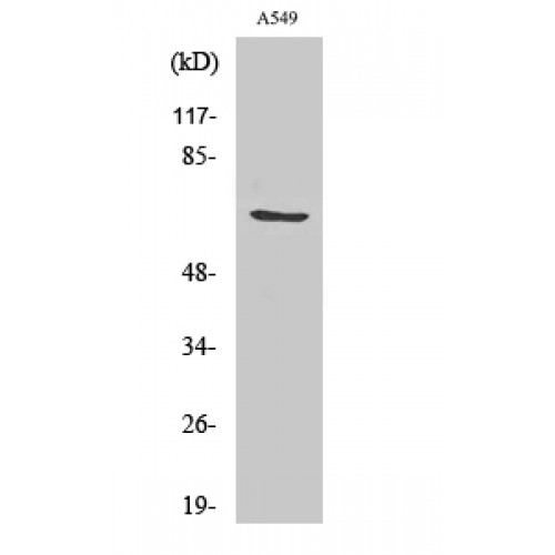 GCLC Antibody - Western blot of GCSc-gamma antibody