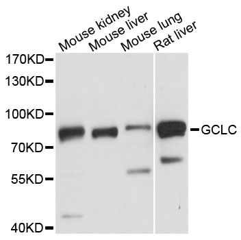 GCLC Antibody - Western blot analysis of extracts of various cell lines, using GCLC antibody at 1:3000 dilution. The secondary antibody used was an HRP Goat Anti-Rabbit IgG (H+L) at 1:10000 dilution. Lysates were loaded 25ug per lane and 3% nonfat dry milk in TBST was used for blocking. An ECL Kit was used for detection and the exposure time was 3s.