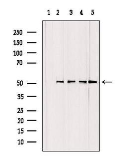 GCLC Antibody - Western blot analysis of extracts of various samples using GCSc-gamma antibody. Lane 1: HeLa treated with blocking peptide. Lane 2: HeLa; Lane 3: mouse Myeloma cells; Lane 4: mouse lung; Lane 5: rat barin;