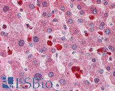 GCLM Antibody - Anti-GCLM antibody IHC of human liver. Immunohistochemistry of formalin-fixed, paraffin-embedded tissue after heat-induced antigen retrieval. Antibody concentration 5 ug/ml.  This image was taken for the unconjugated form of this product. Other forms have not been tested.