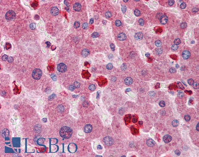 GCLM Antibody - Anti-GCLM antibody IHC of human liver. Immunohistochemistry of formalin-fixed, paraffin-embedded tissue after heat-induced antigen retrieval. Antibody concentration 5 ug/ml.  This image was taken for the unconjugated form of this product. Other forms have not been tested.