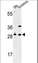 GCLM Antibody - Western blot of GCLM Antibody in 293 cell line and mouse kidney tissue lysates (35 ug/lane). GCLM (arrow) was detected using the purified antibody.