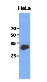GCLM Antibody - Western Blot: The cell lysates of HeLa (40 ug) were resolved by SDS-PAGE, transferred to PVDF membrane and probed with anti-human GCLM antibody (1:3000). Proteins were visualized using a goat anti-mouse secondary antibody conjugated to HRP and an ECL detection system.