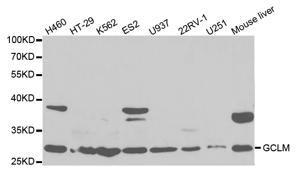 GCLM Antibody - Western blot analysis of extracts of various cell lines.