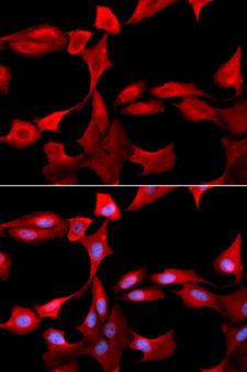 GCLM Antibody - Immunofluorescence analysis of U20S cells.