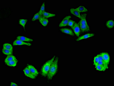 GCLM Antibody - Immunofluorescent analysis of HepG2 cells at a dilution of 1:100 and Alexa Fluor 488-congugated AffiniPure Goat Anti-Rabbit IgG(H+L)