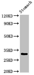 GCLM Antibody - Positive Western Blot detected in Rat stomach tissue. All lanes: GCLM antibody at 3 µg/ml Secondary Goat polyclonal to rabbit IgG at 1/50000 dilution. Predicted band size: 31, 29 KDa. Observed band size: 31 KDa