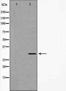 GCLM Antibody - Western blot analysis of MCF-7 cell lysates using GCLM antibody. The lane on the left is treated with the antigen-specific peptide.