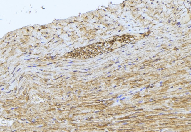 GCLM Antibody - 1:100 staining mouse muscle tissue by IHC-P. The sample was formaldehyde fixed and a heat mediated antigen retrieval step in citrate buffer was performed. The sample was then blocked and incubated with the antibody for 1.5 hours at 22°C. An HRP conjugated goat anti-rabbit antibody was used as the secondary.