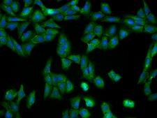 GCLM Antibody - Immunofluorescence staining of GCLM in U2OS cells. Cells were fixed with 4% PFA, permeabilzed with 0.1% Triton X-100 in PBS, blocked with 10% serum, and incubated with rabbit anti-Human GCLM polyclonal antibody (dilution ratio 1:200) at 4°C overnight. Then cells were stained with the Alexa Fluor 488-conjugated Goat Anti-rabbit IgG secondary antibody (green) and counterstained with DAPI (blue). Positive staining was localized to Cytoplasm.