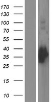 GCLM Protein - Western validation with an anti-DDK antibody * L: Control HEK293 lysate R: Over-expression lysate