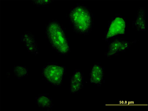 GCM1 Antibody - Immunofluorescence of monoclonal antibody to GCM1 on HeLa cell. [antibody concentration 10 ug/ml]