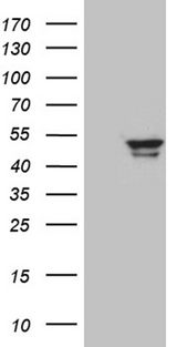 GCM1 Antibody - HEK293T cells were transfected with the pCMV6-ENTRY control. (Left lane) or pCMV6-ENTRY GCM1. (Right lane) cDNA for 48 hrs and lysed. Equivalent amounts of cell lysates. (5 ug per lane) were separated by SDS-PAGE and immunoblotted with anti-GCM1. (1:2000)