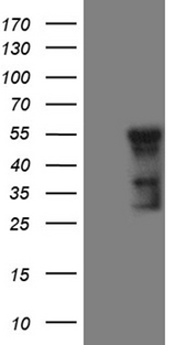 GCM1 Antibody - HEK293T cells were transfected with the pCMV6-ENTRY control. (Left lane) or pCMV6-ENTRY GCM1. (Right lane) cDNA for 48 hrs and lysed. Equivalent amounts of cell lysates. (5 ug per lane) were separated by SDS-PAGE and immunoblotted with anti-GCM1. (1:2000)