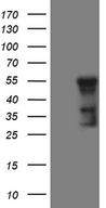 GCM1 Antibody - HEK293T cells were transfected with the pCMV6-ENTRY control. (Left lane) or pCMV6-ENTRY GCM1. (Right lane) cDNA for 48 hrs and lysed