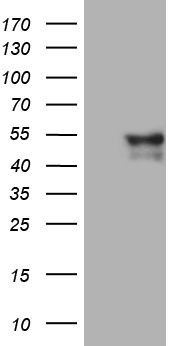 GCM1 Antibody - HEK293T cells were transfected with the pCMV6-ENTRY control. (Left lane) or pCMV6-ENTRY GCM1. (Right lane) cDNA for 48 hrs and lysed. Equivalent amounts of cell lysates. (5 ug per lane) were separated by SDS-PAGE and immunoblotted with anti-GCM1. (1:2000)