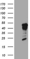GCM1 Antibody - HEK293T cells were transfected with the pCMV6-ENTRY control. (Left lane) or pCMV6-ENTRY GCM1. (Right lane) cDNA for 48 hrs and lysed. Equivalent amounts of cell lysates. (5 ug per lane) were separated by SDS-PAGE and immunoblotted with anti-GCM1. (1:2000)