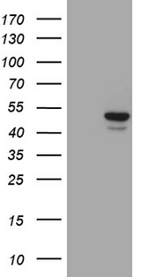 GCM1 Antibody - HEK293T cells were transfected with the pCMV6-ENTRY control. (Left lane) or pCMV6-ENTRY GCM1. (Right lane) cDNA for 48 hrs and lysed. Equivalent amounts of cell lysates. (5 ug per lane) were separated by SDS-PAGE and immunoblotted with anti-GCM1. (1:2000)