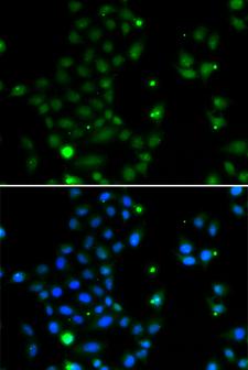 GCM1 Antibody - Immunofluorescence analysis of MCF7 cells.