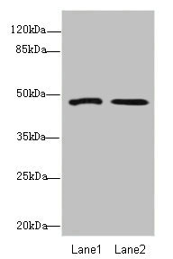 GCM1 Antibody - Western blot All Lanes: GCM1antibody at 1.67ug/ml Lane 1: Hela whole cell lysate Lane 2: HepG-2 whole cell lysate Secondary Goat polyclonal to Rabbit IgG at 1/10000 dilution Predicted band size: 49 kDa Observed band size: 49 kDa